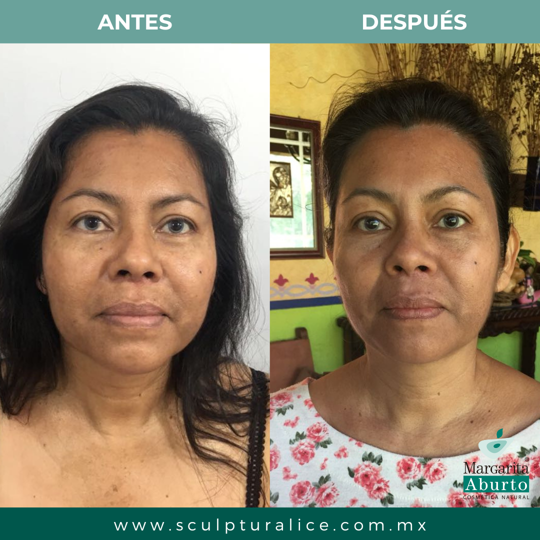 Paquete 10 Barras Sculptural Ice Facial