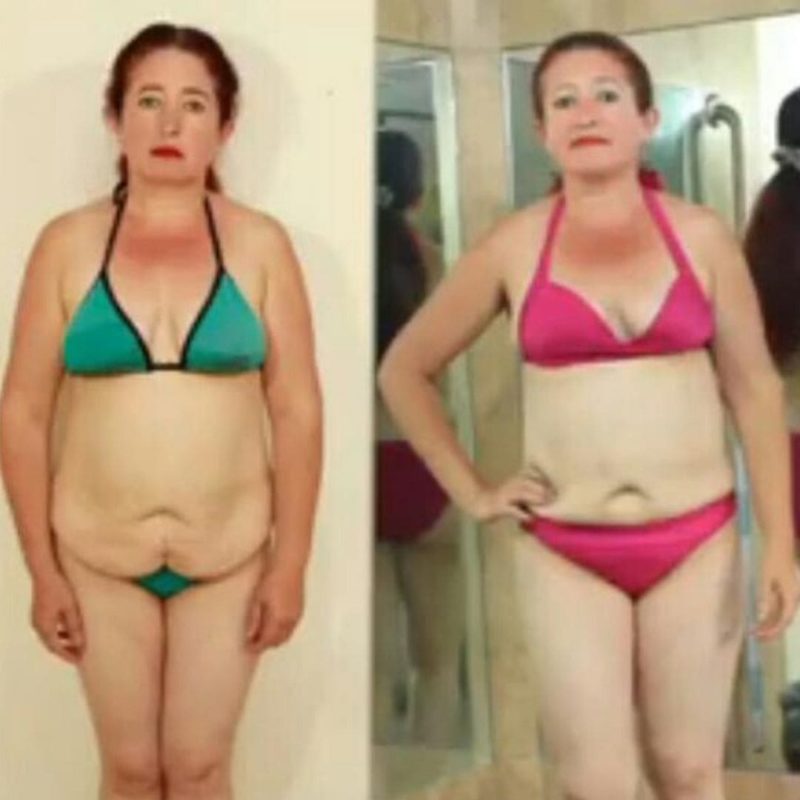 Paquete Especial Corporal + Facial